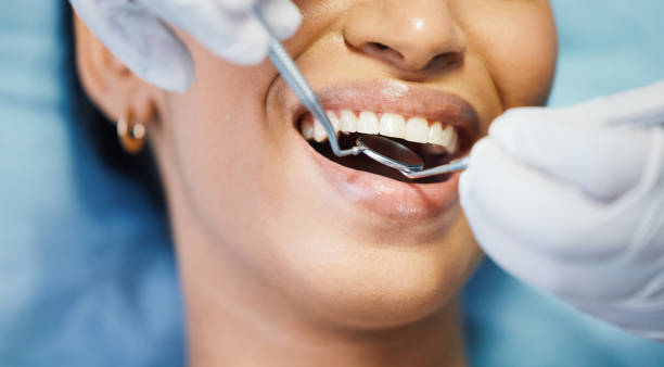 Best Urgent Care for Lost Fillings or Crowns in Santa Rita Ranch, TX